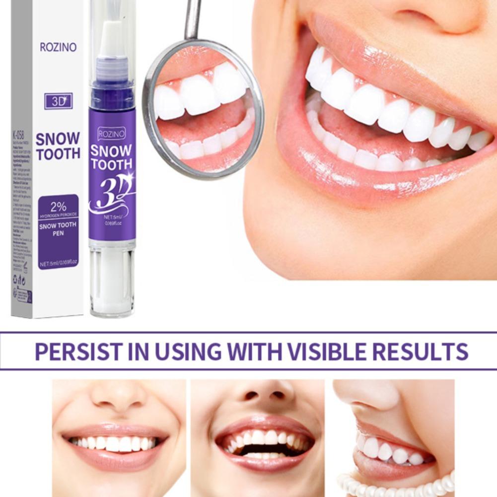 قلم تبييض الأسنان بتقنية ثلاثي - مراجعة Teeth Whitening Pens وسعره