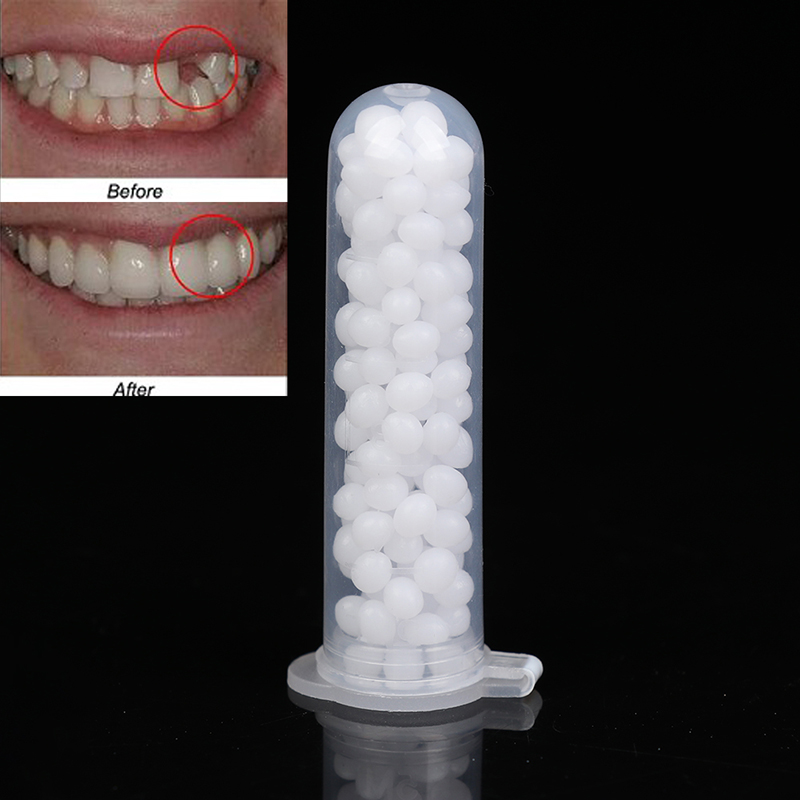 【K】1 علبة مجموعة إصلاح الأسنان - مراجعة Teeth Whitening Kit وسعره