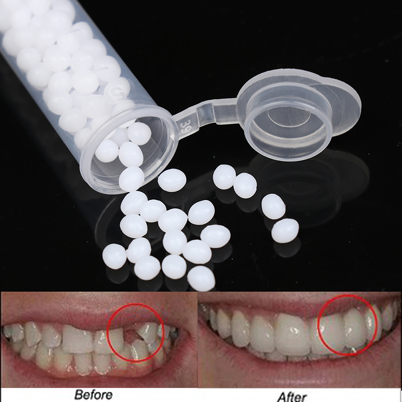 【K】1 علبة مجموعة إصلاح الأسنان - مراجعة Teeth Whitening Kit وسعره