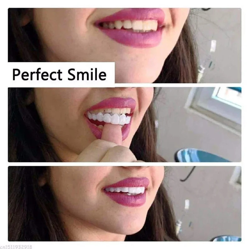 طقم قشرة أسنان قابلة للتركيب،  - مراجعة Teeth Whitening Kit وسعره